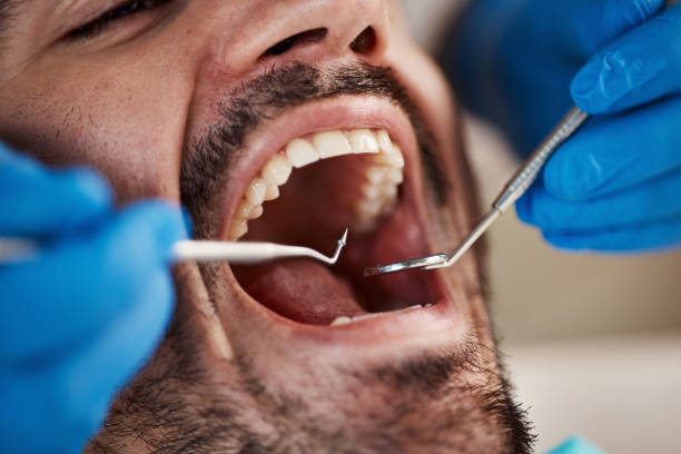 Fast & Reliable Emergency Dental Services in NY